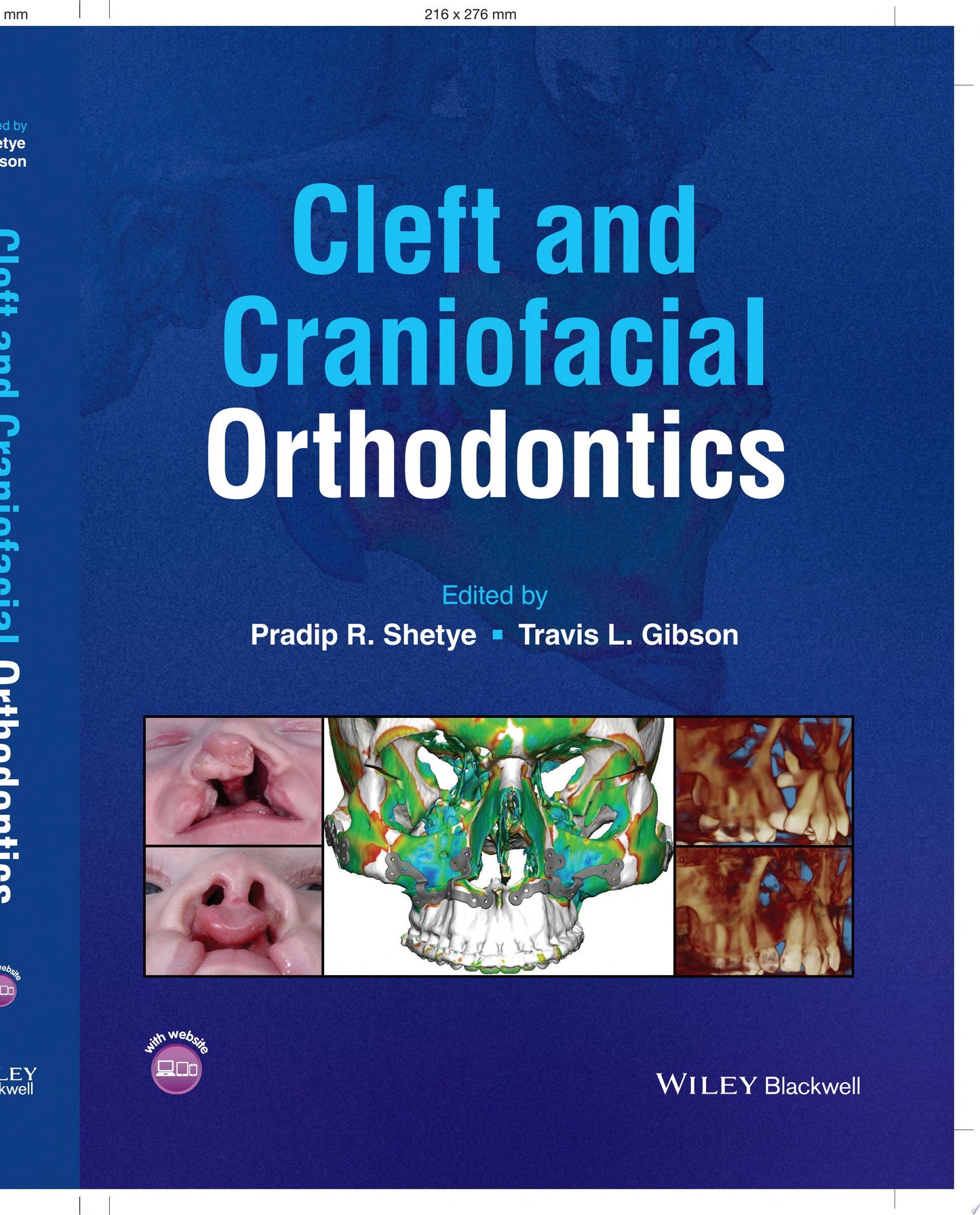 Cleft and Craniofacial Orthodontics