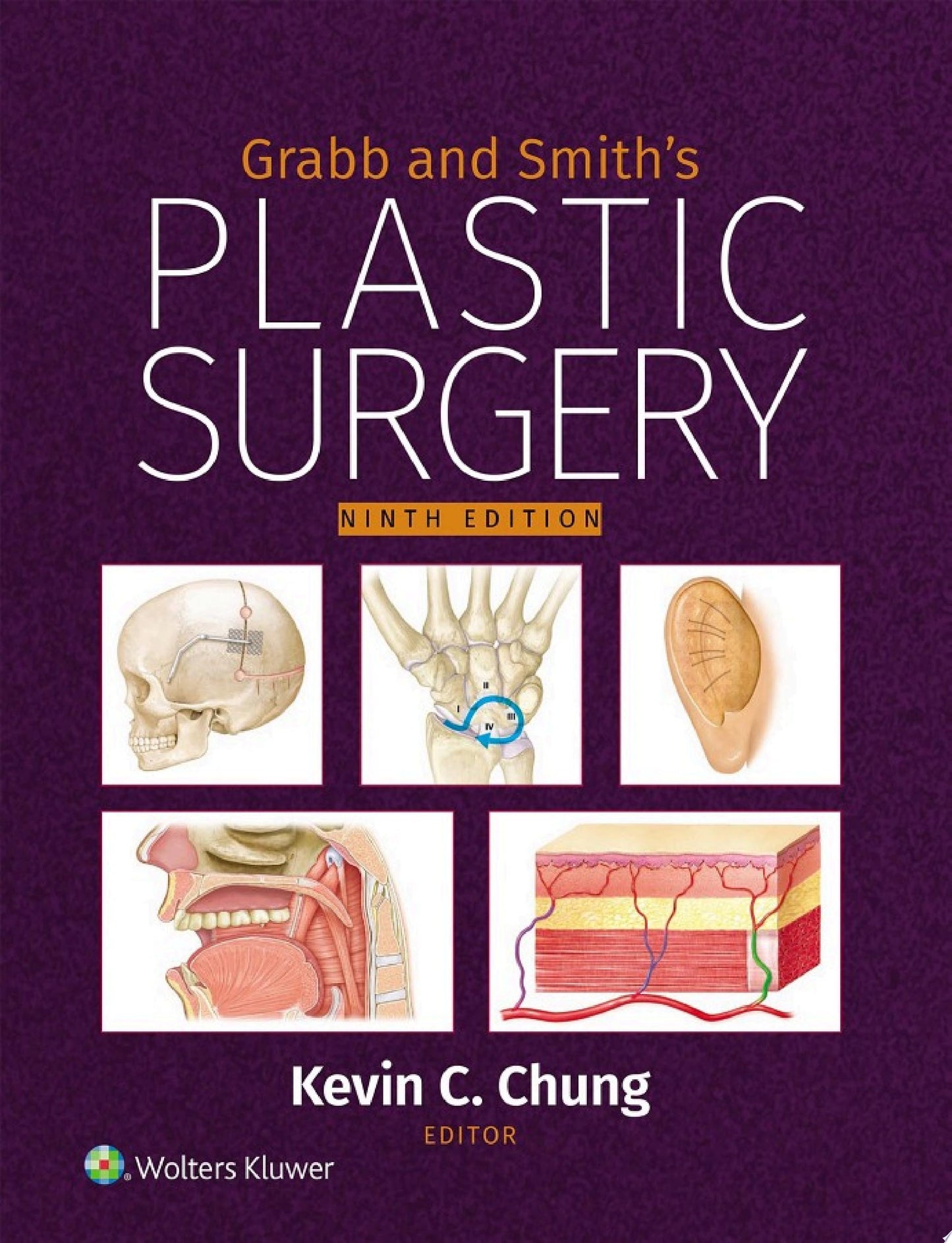 Grabb and Smith’s Plastic Surgery, 9th edition