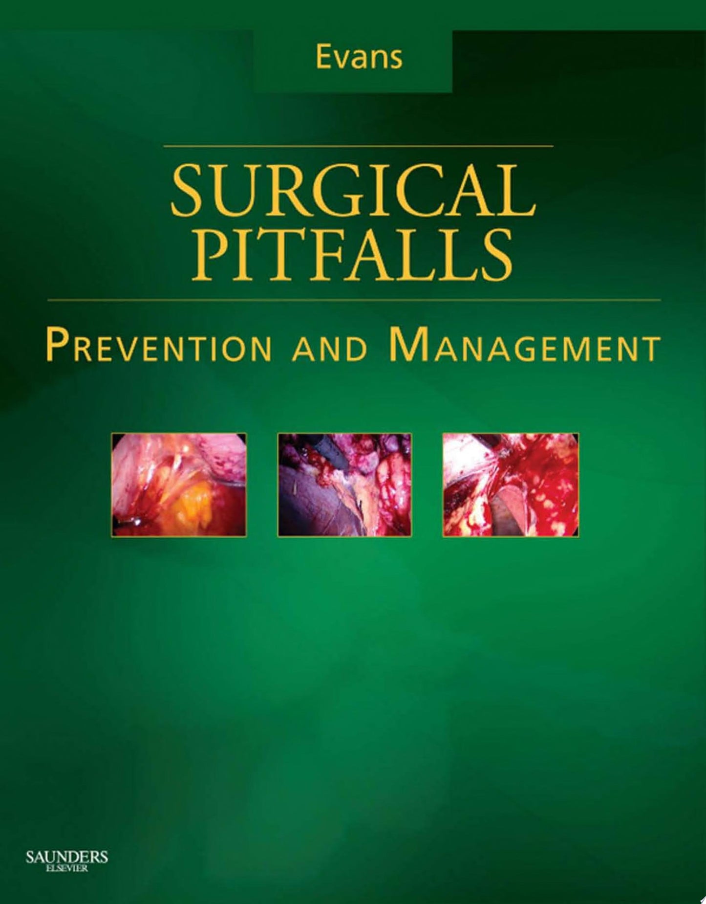 Surgical Pitfalls: Prevention and Management