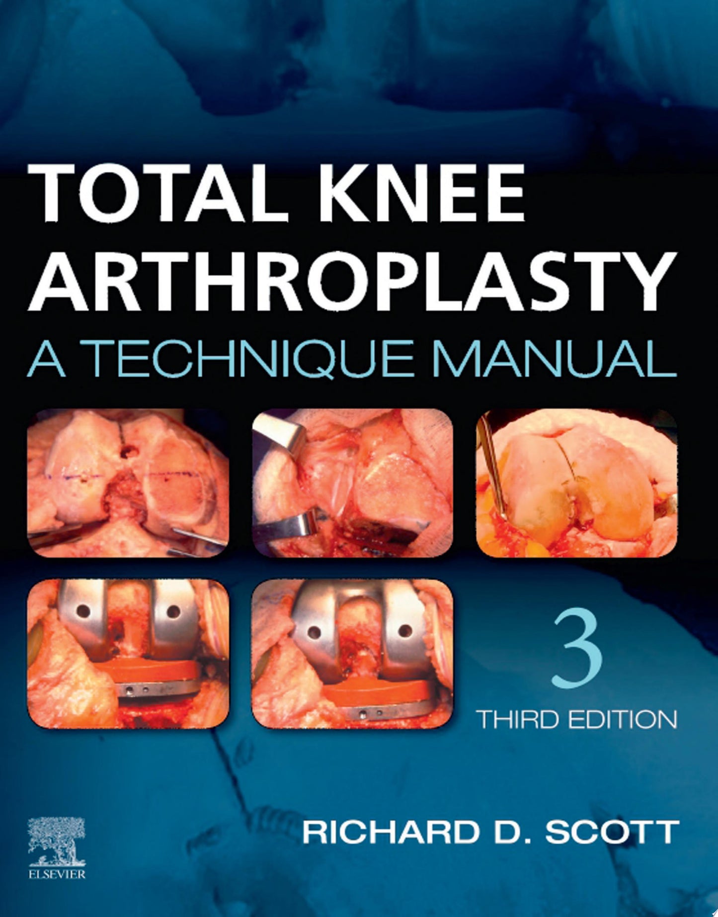 Total Knee Arthroplasty: A Technique Manual, 3rd edition