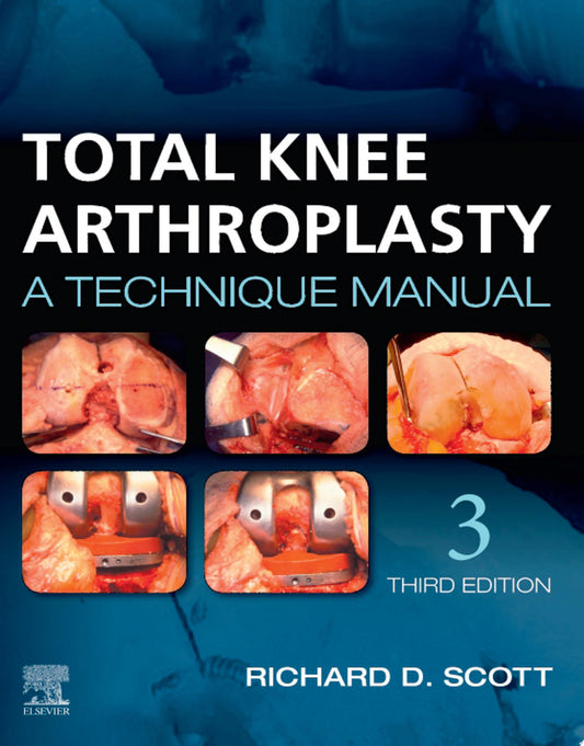 Total Knee Arthroplasty: A Technique Manual, 3rd edition