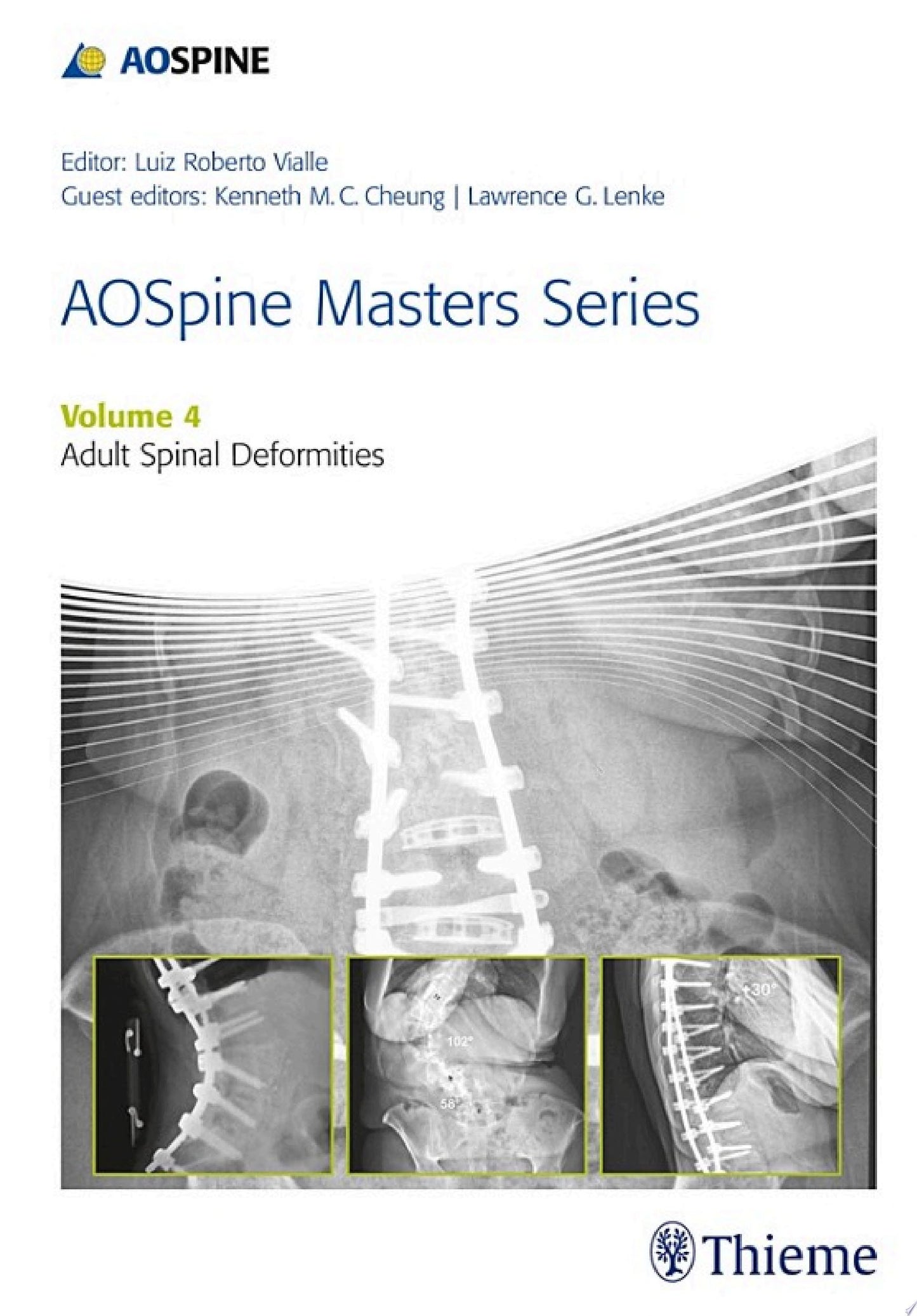 AOSpine Master Series, Vol. 4: Adult Spinal Deformities
