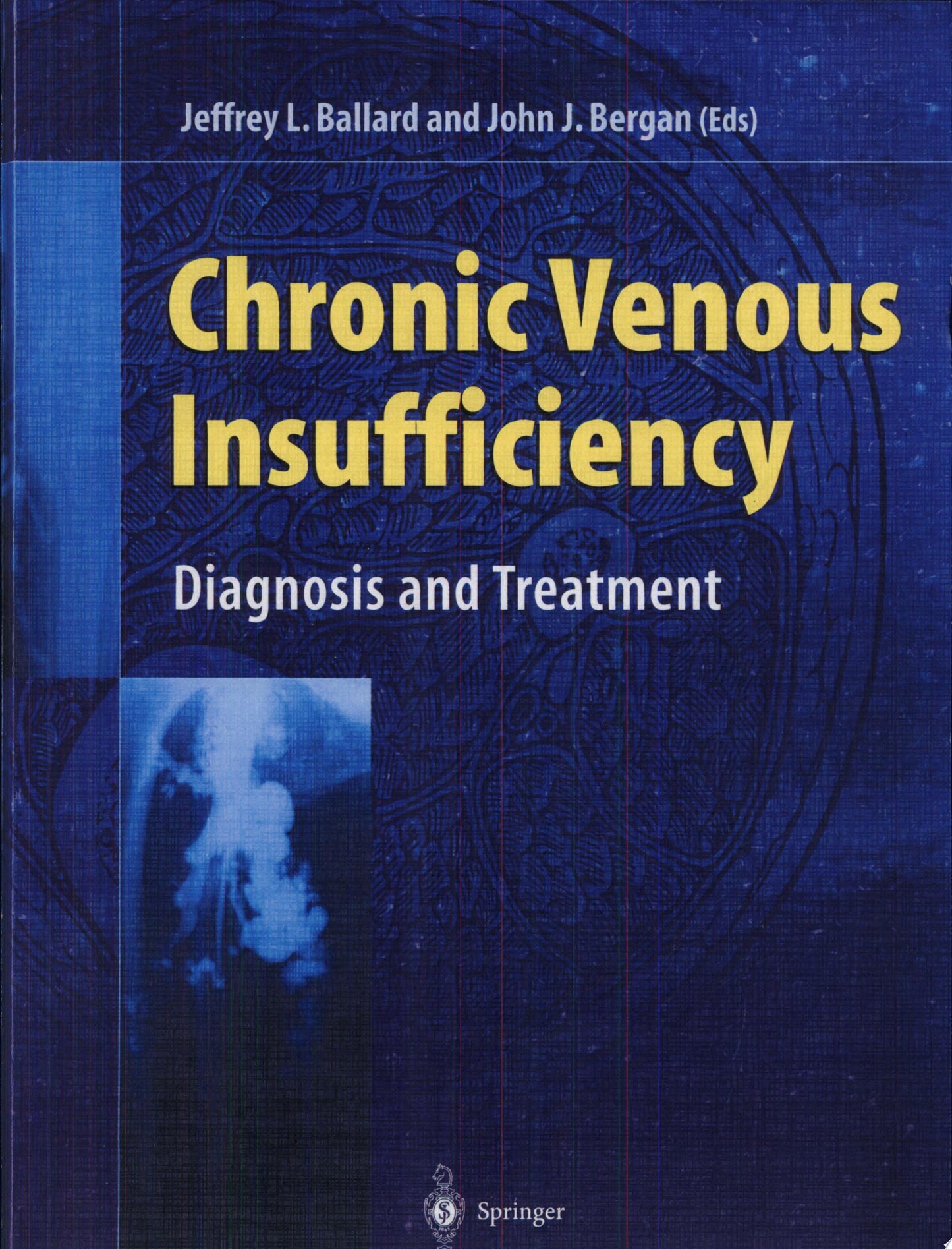 Venous Insufficiency
