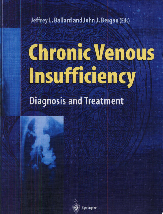 Venous Insufficiency