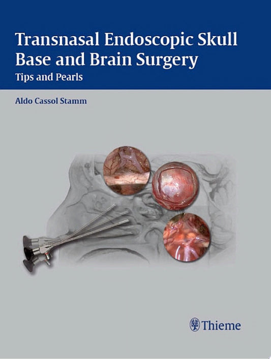Transnasal Endoscopic Skull Base and Brain Surgery: Tips and Pearls