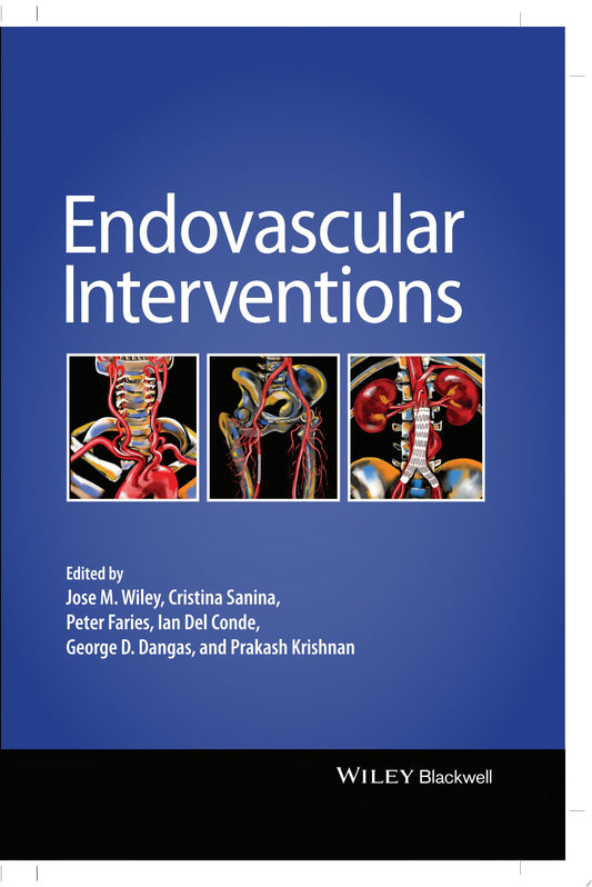 Endovascular Interventions: A Step-by-Step Approach