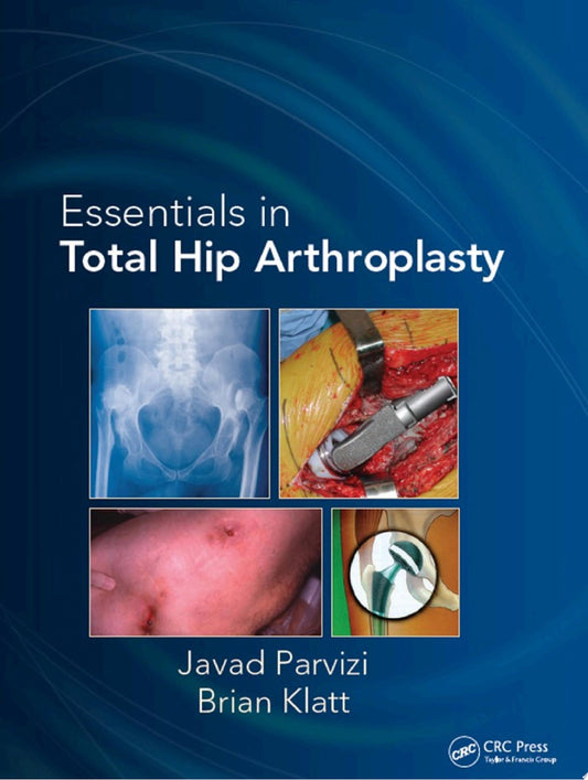 Essentials in Total Hip Arthroplasty