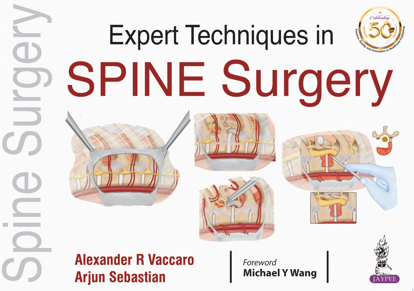 Expert Techniques in Spine Surgery