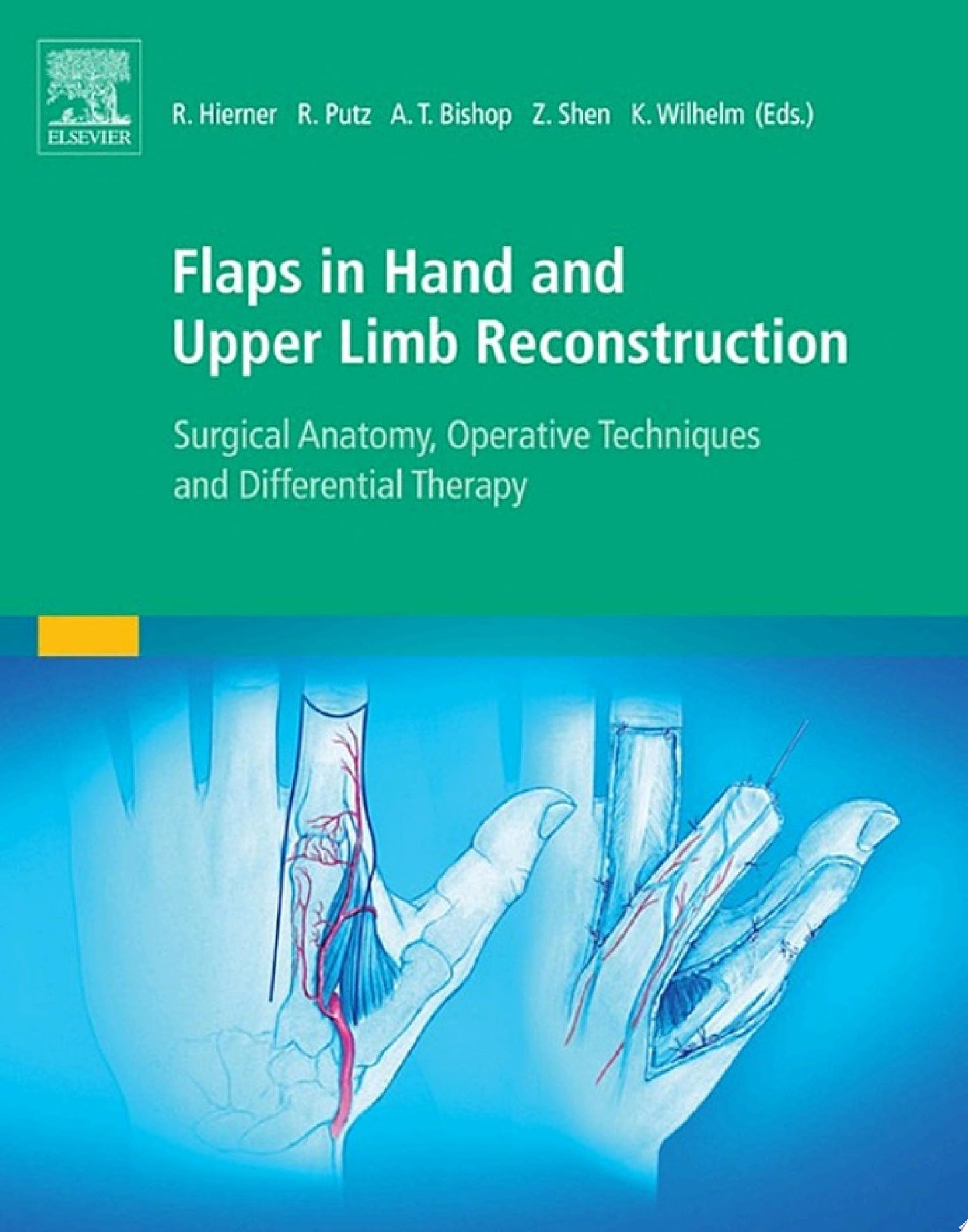 Flaps in Hand and Upper Limb Reconstruction: Surgical Anatomy, Operative Techniques and Differential Therapy