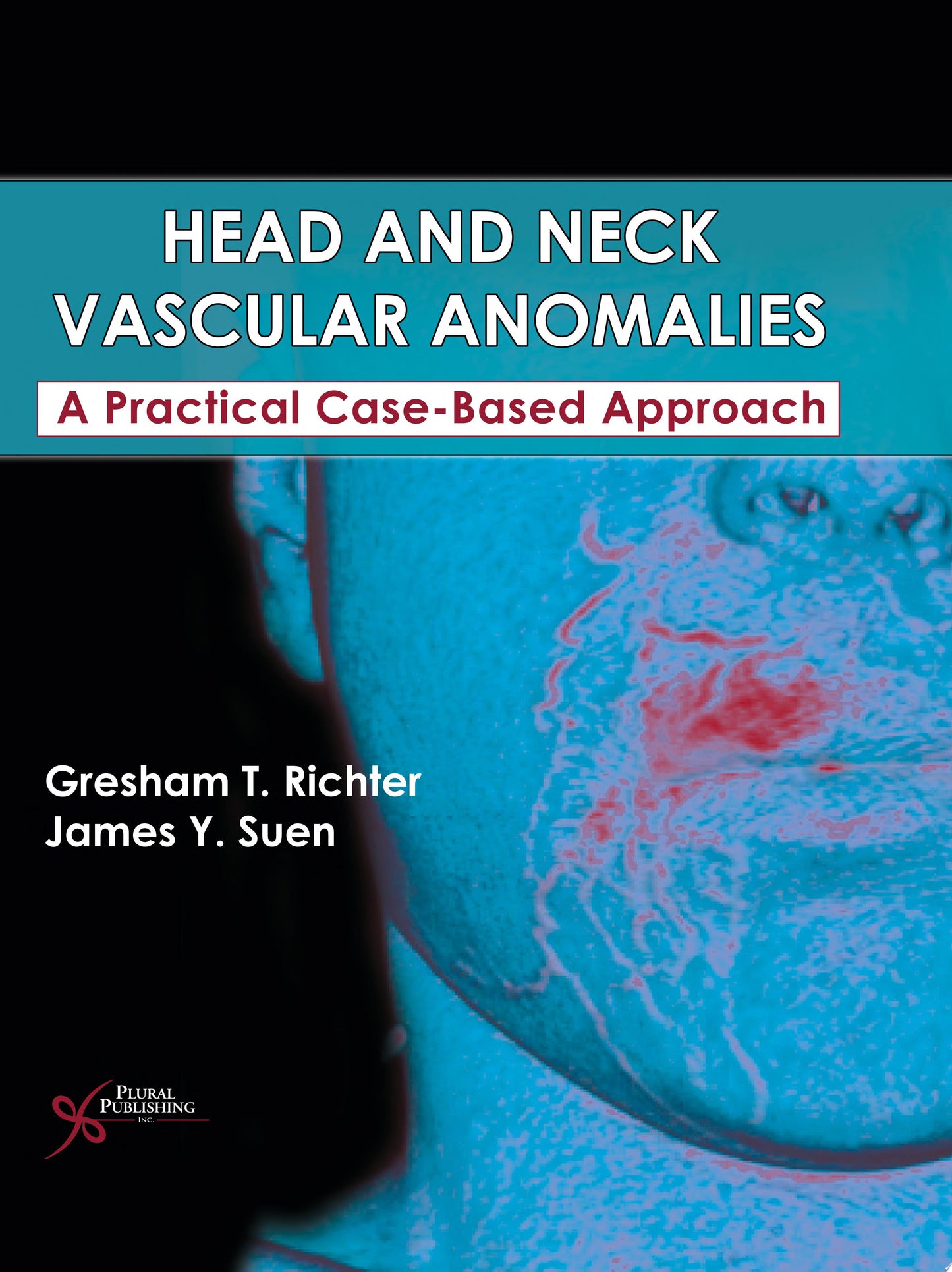 Head and Neck Vascular Anomalies: A Practical Case-Based Approach