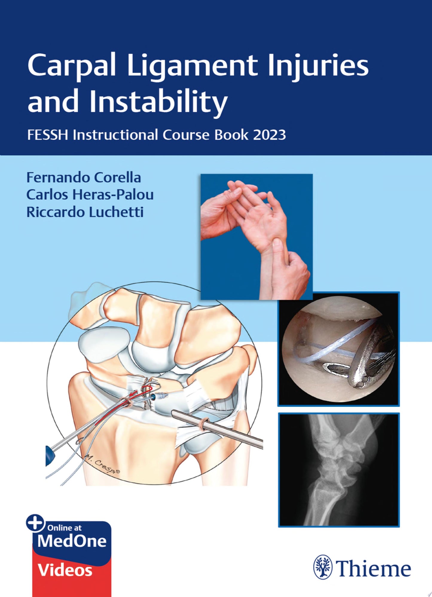 Carpal Ligament Injuries and Instability: FESSH Instructional Course Book 2023