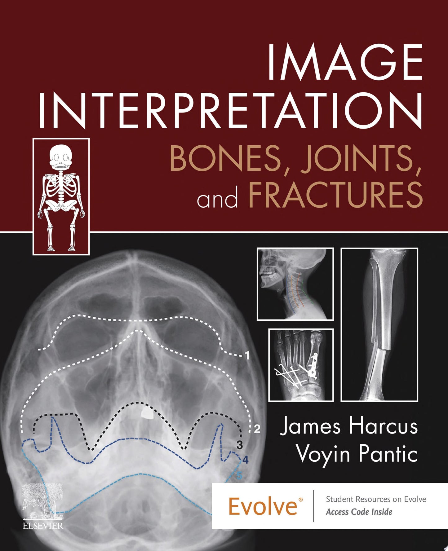 Bones and Joints: A Guide for Students, 8th edition