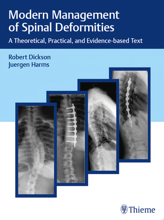 Modern Management of Spinal Deformities: A Theoretical, Practical, and Evidence-based Text