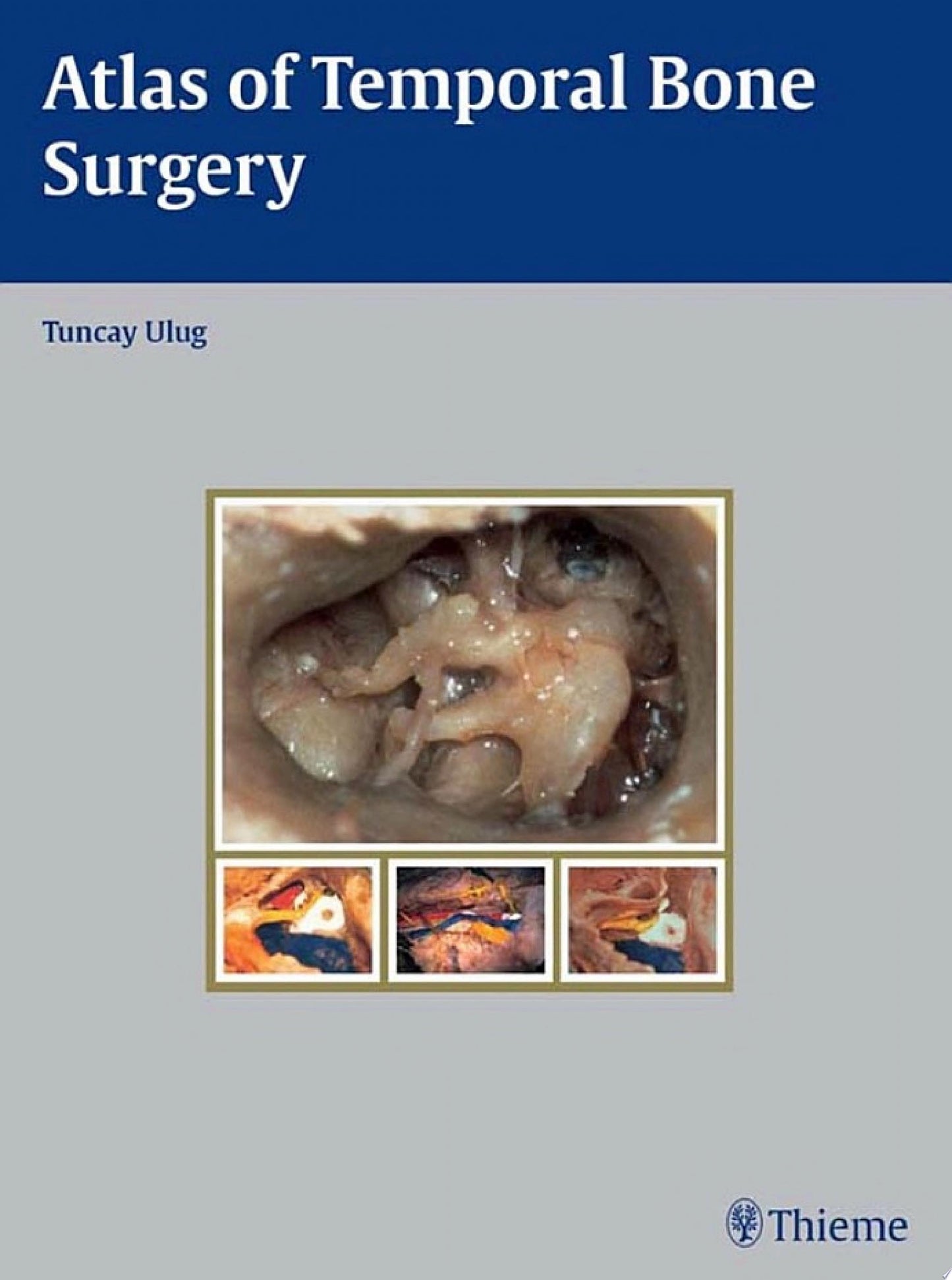 Atlas of Temporal Bone Surgery