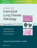 Atlas of Interstitial Lung Disease Pathology, 2ed