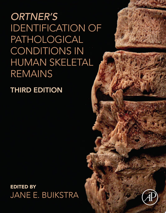 Ortner’s Identification of Pathological Conditions in Human Skeletal Remains, 3rd Edition