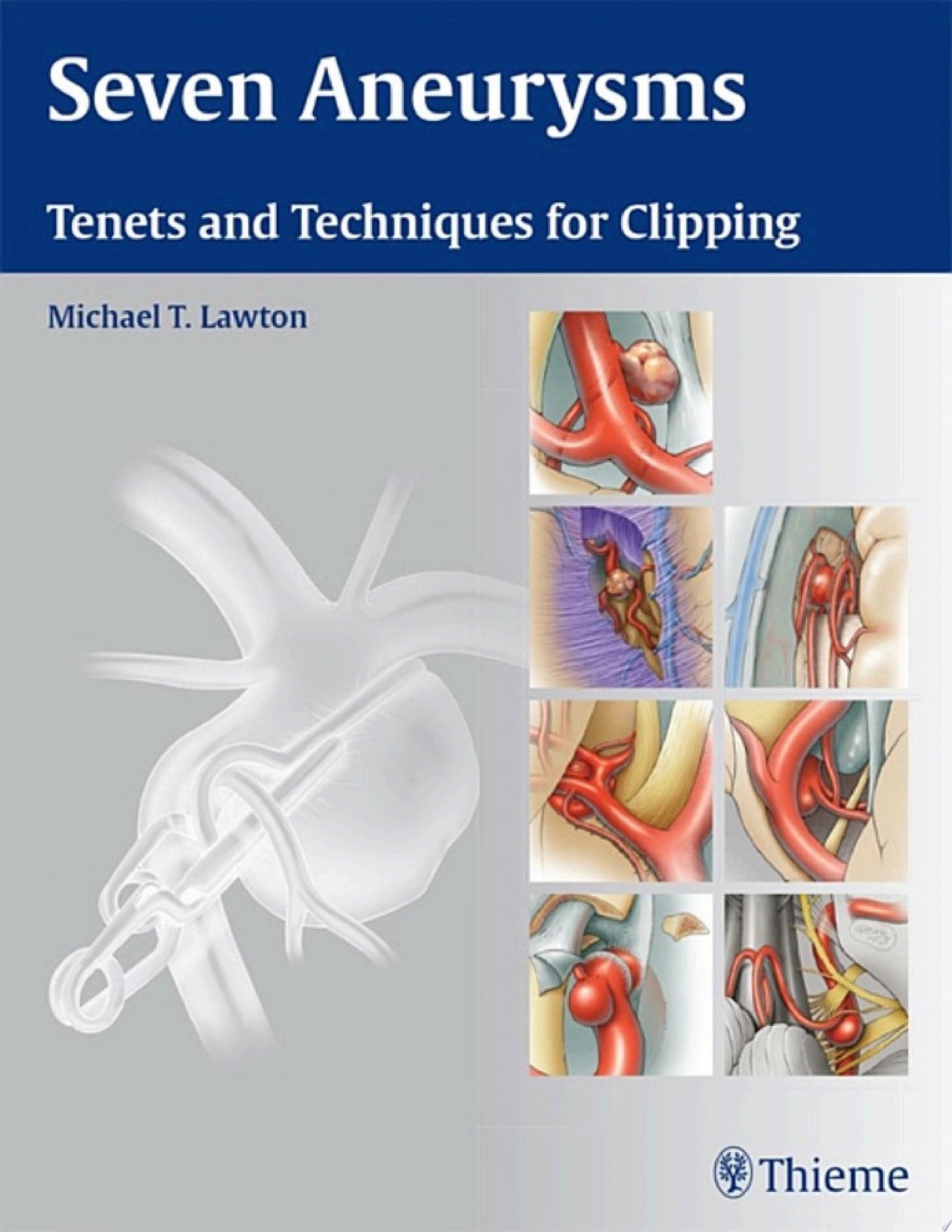 Seven Aneurysms: Tenets and Techniques for Clipping