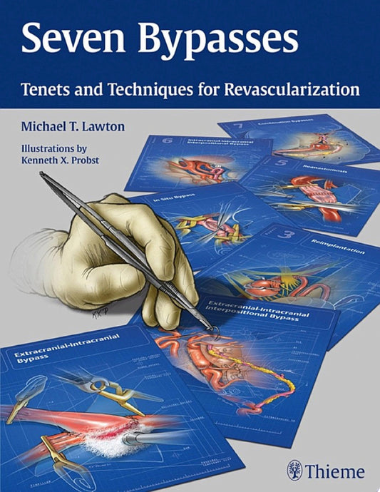 Seven Bypasses: Tenets and Techniques for Revascularization 1st Edition