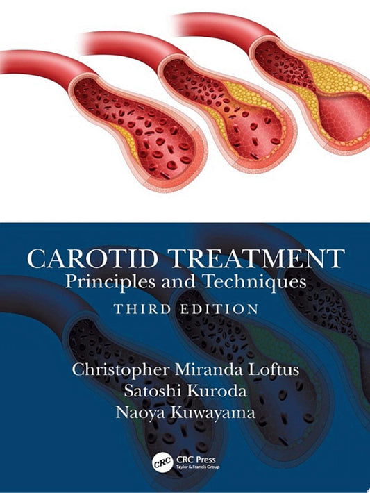 Carotid Treatment: Principles and Techniques, 3rd Edition