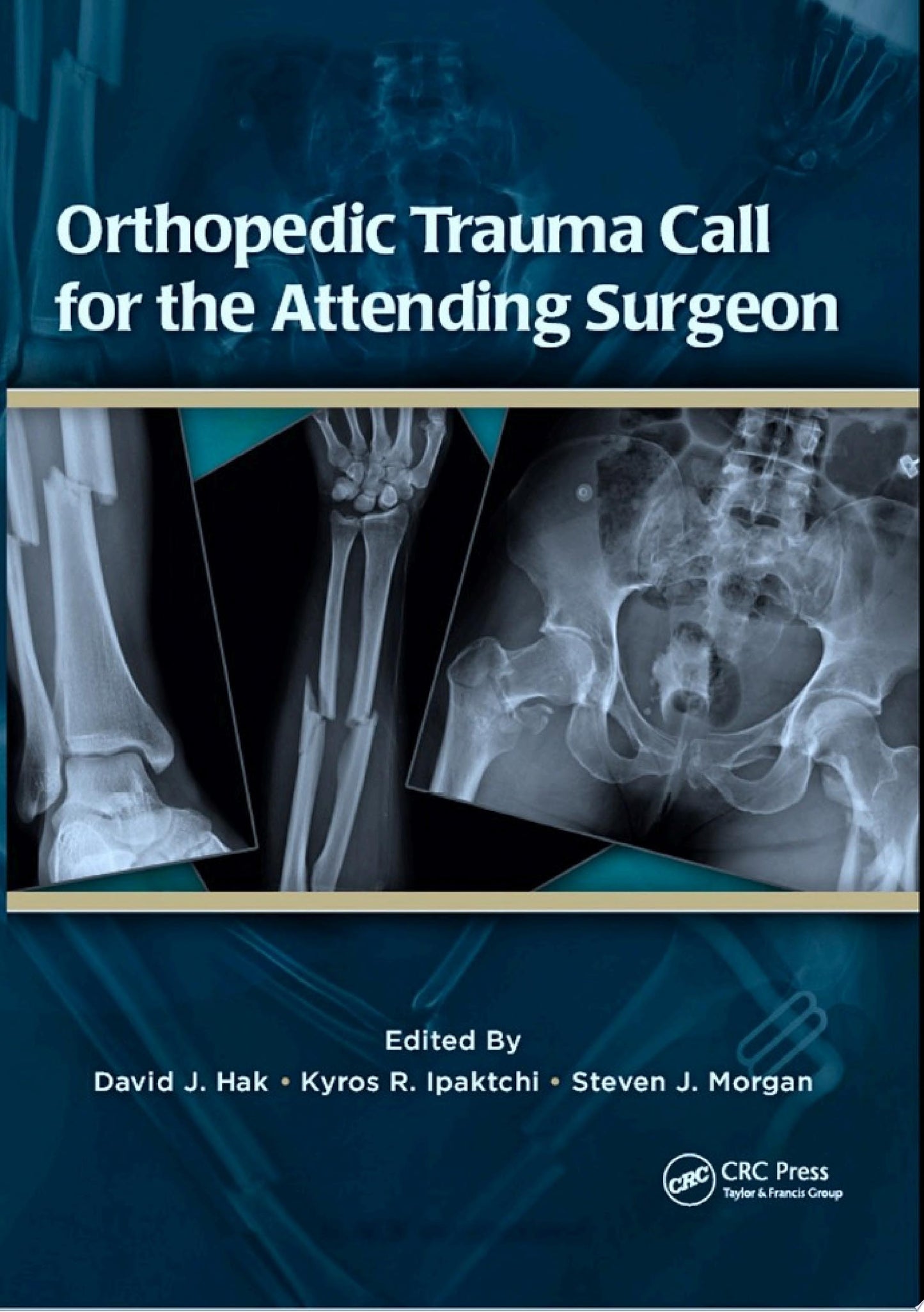 Orthopedic Trauma Call for the Attending Surgeon