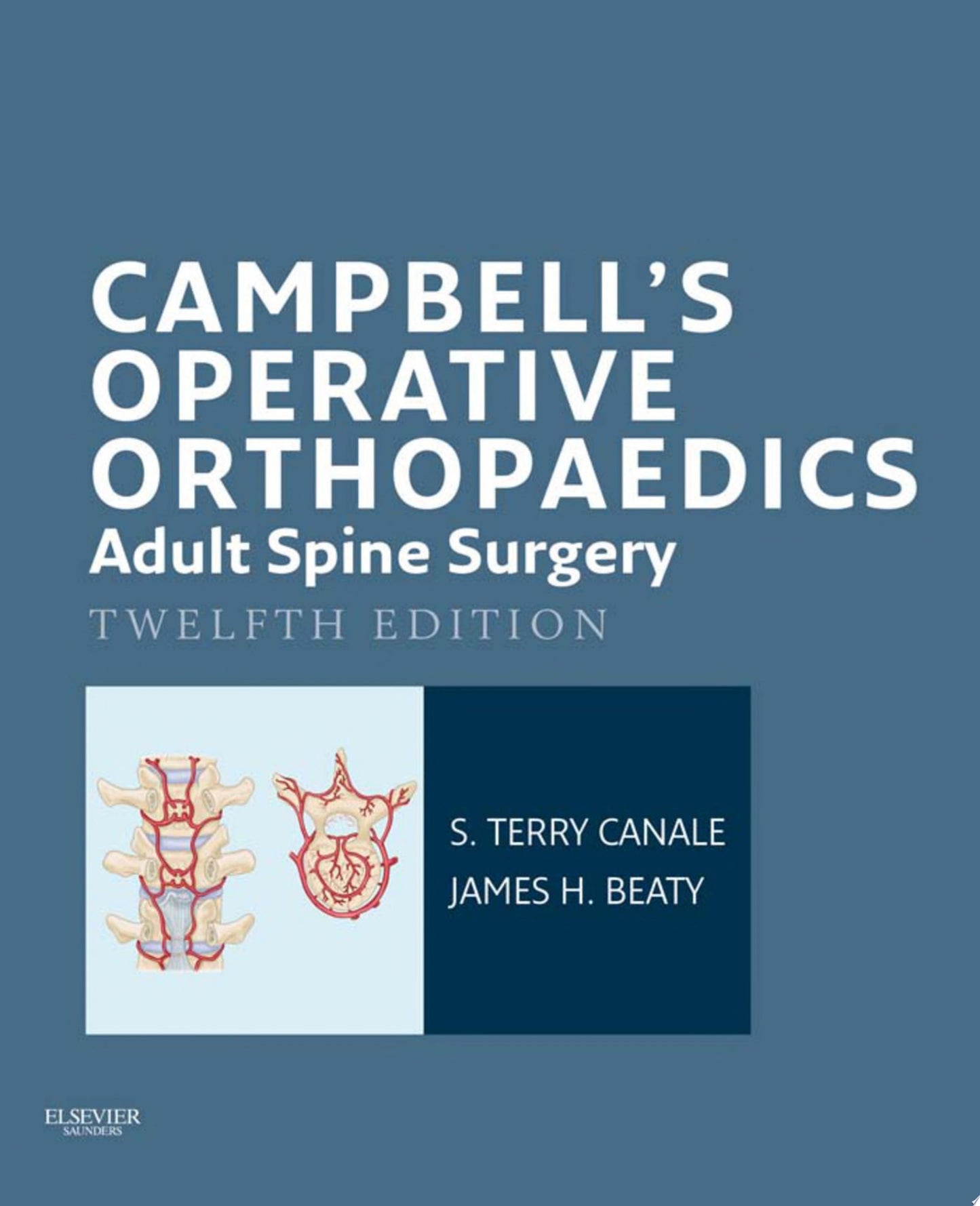 Campbell’s Operative Orthopaedics: Adult Spine Surgery