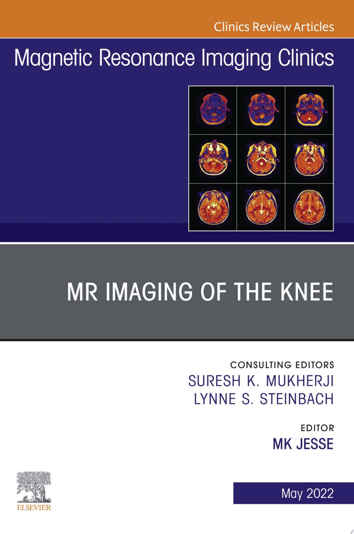 MRI of the Knee, An Issue of Magnetic Resonance Imaging Clinics of North America