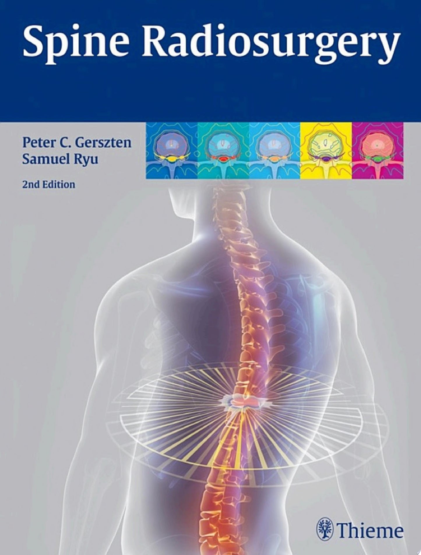 Spine Radiosurgery, 2nd Edition