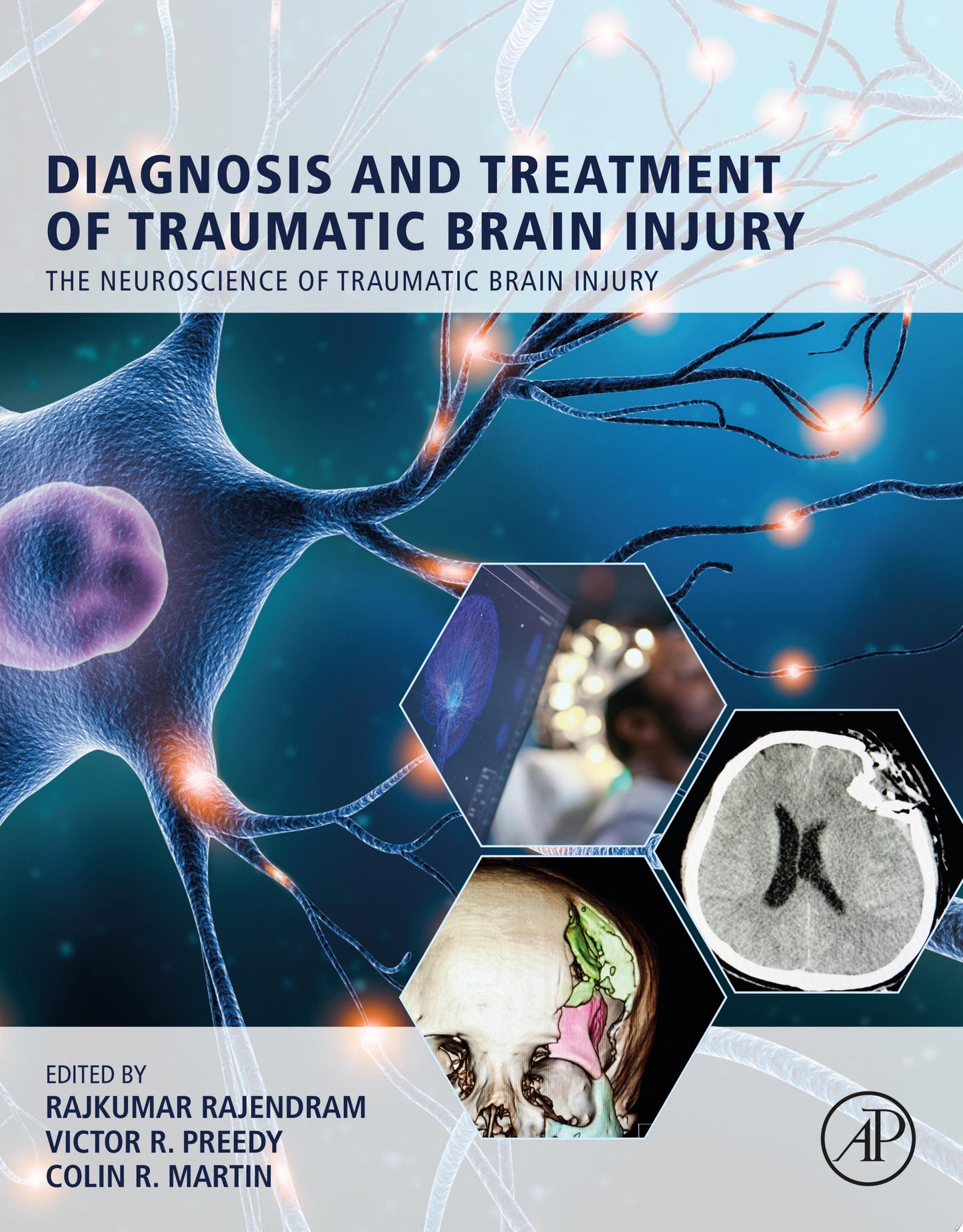 Diagnosis and Treatment of Traumatic Brain Injury