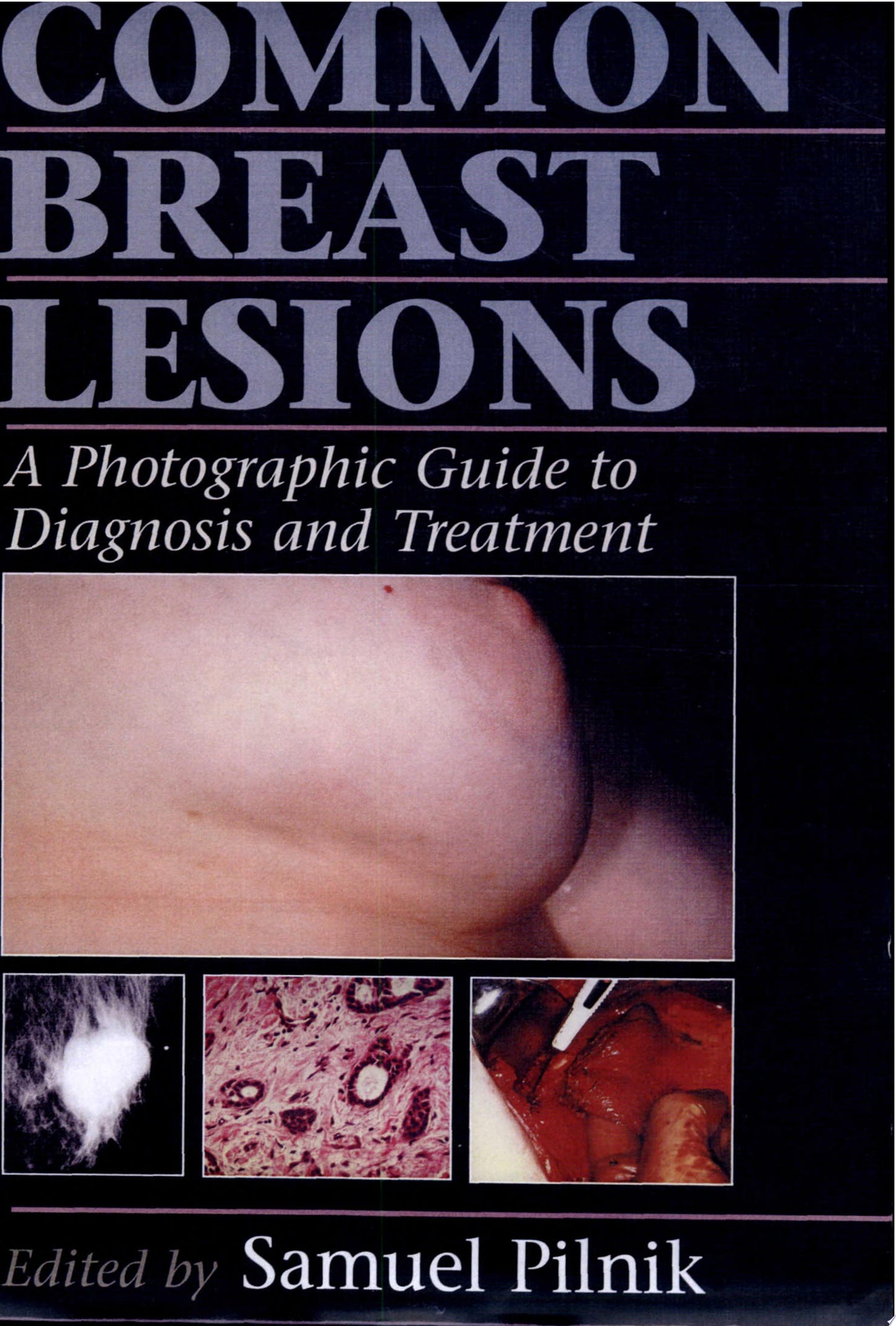 Male Breast Enlargement