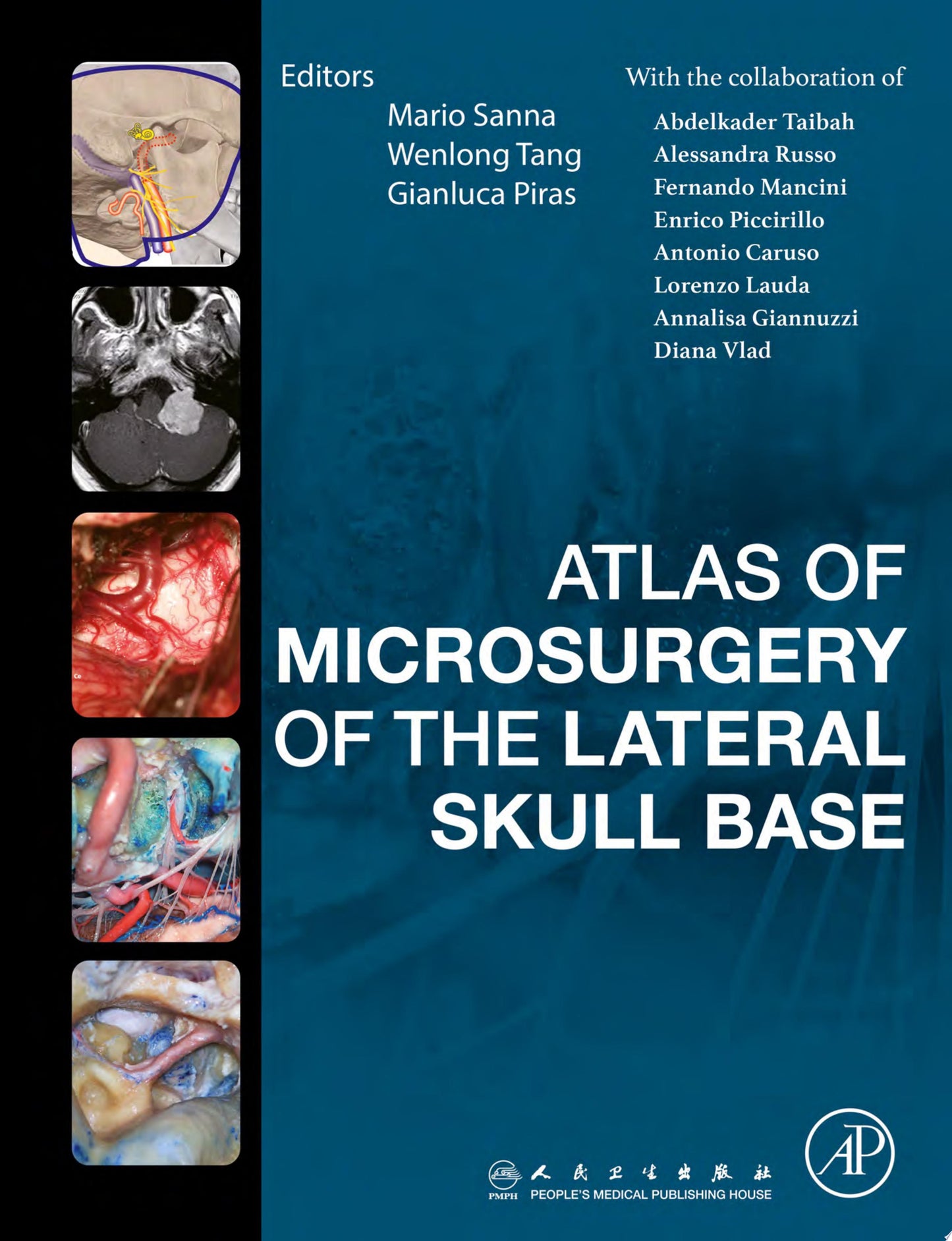 Atlas of Microsurgery of the Lateral Skull Base