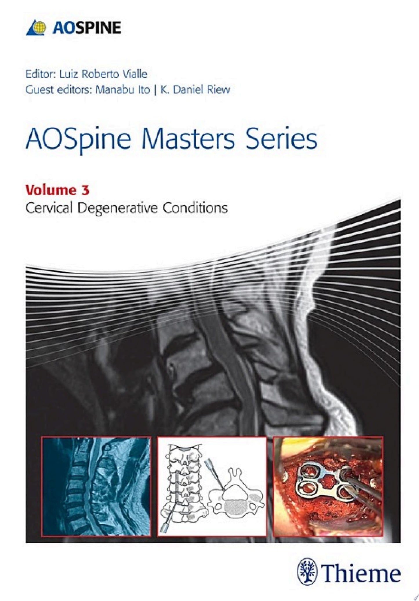 AOSpine Masters Series Volume 3: Cervical Degenerative Conditions